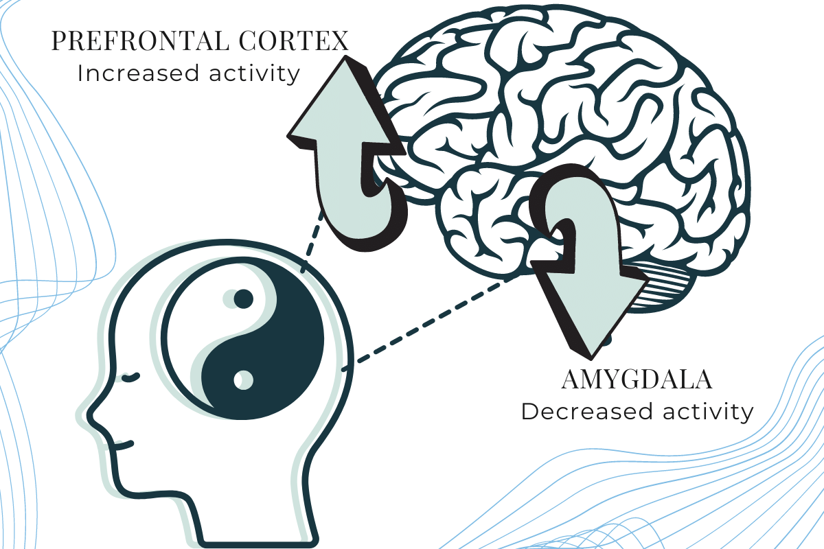 MDMA assisted therapy reduces amygdala activity